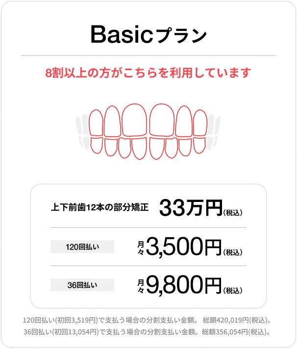 Basicプラン、上下前歯12本の部分矯正33万円(税込)、120回払い 月々3,500円(税込)、36回払い 月々9,800円(税込)