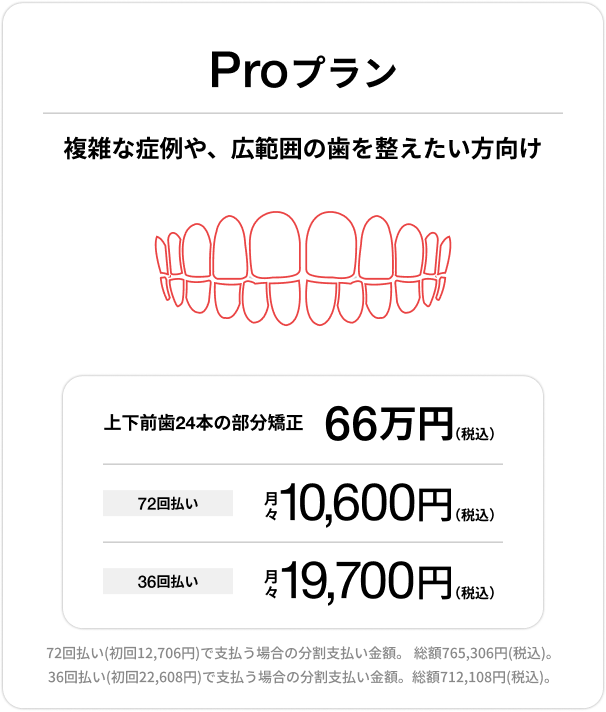 Proプラン、上下前歯24本の部分矯正66万円(税込)、72回払い 月々10,600円(税込)、36回払い 月々19,700円(税込)
