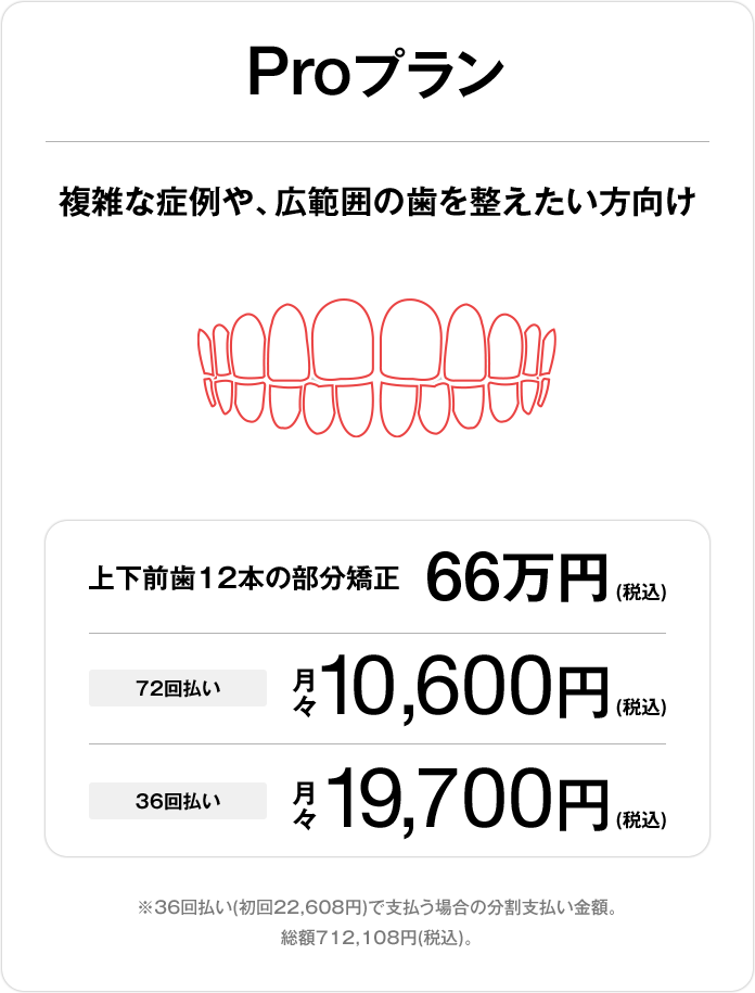Proプラン、上下前歯24本の部分矯正66万円(税込)、72回払い 月々10,600円(税込)、36回払い 月々19,700円(税込)
